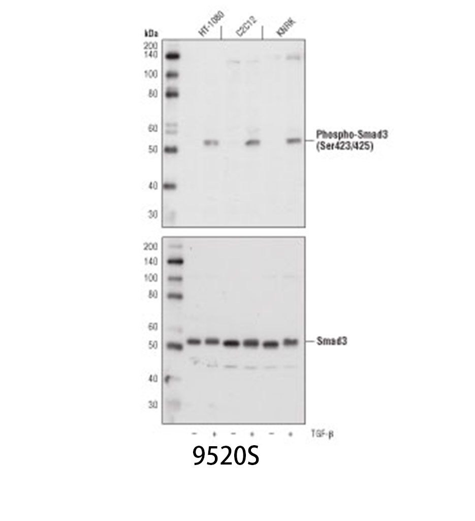 Phospho-Smad3 (Ser423/425) (C25A9) Rabbit mAb