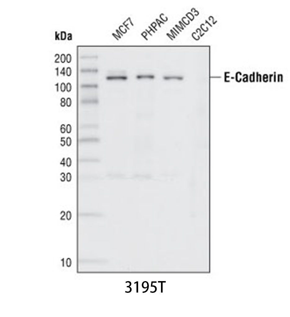 E-Cadherin (24E10) Rabbit mAb