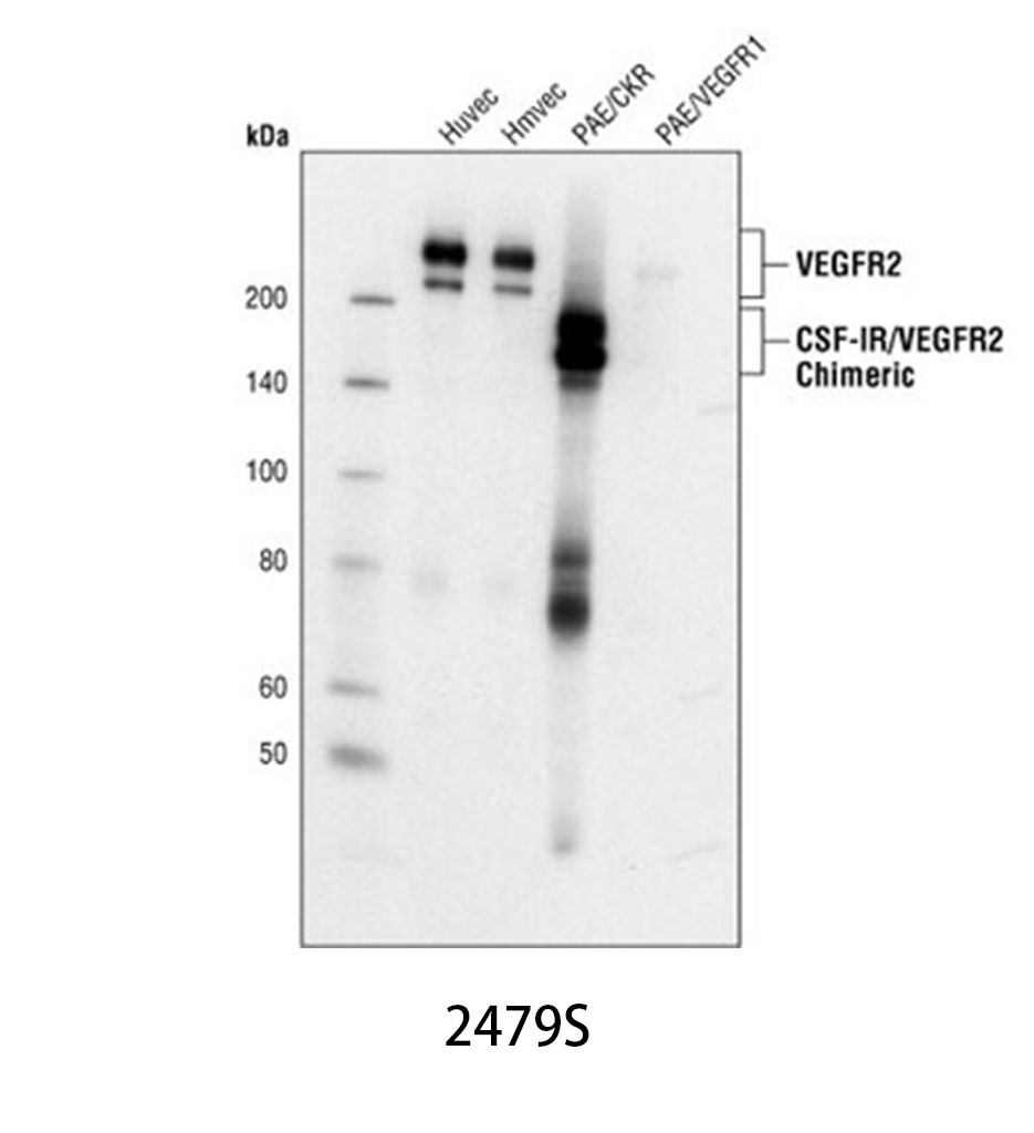 VEGF Receptor 2 (55B11) Rabbit mAb