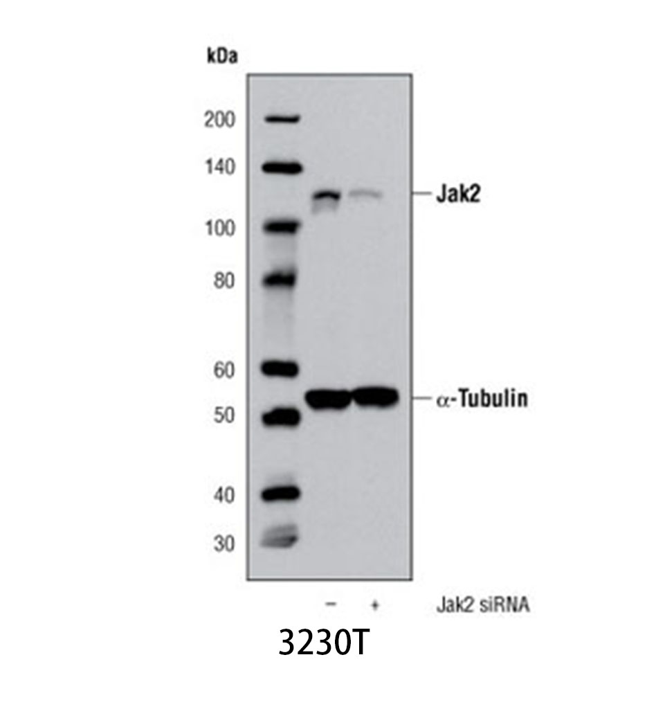 Jak2 (D2E12) XP Rabbit mAb