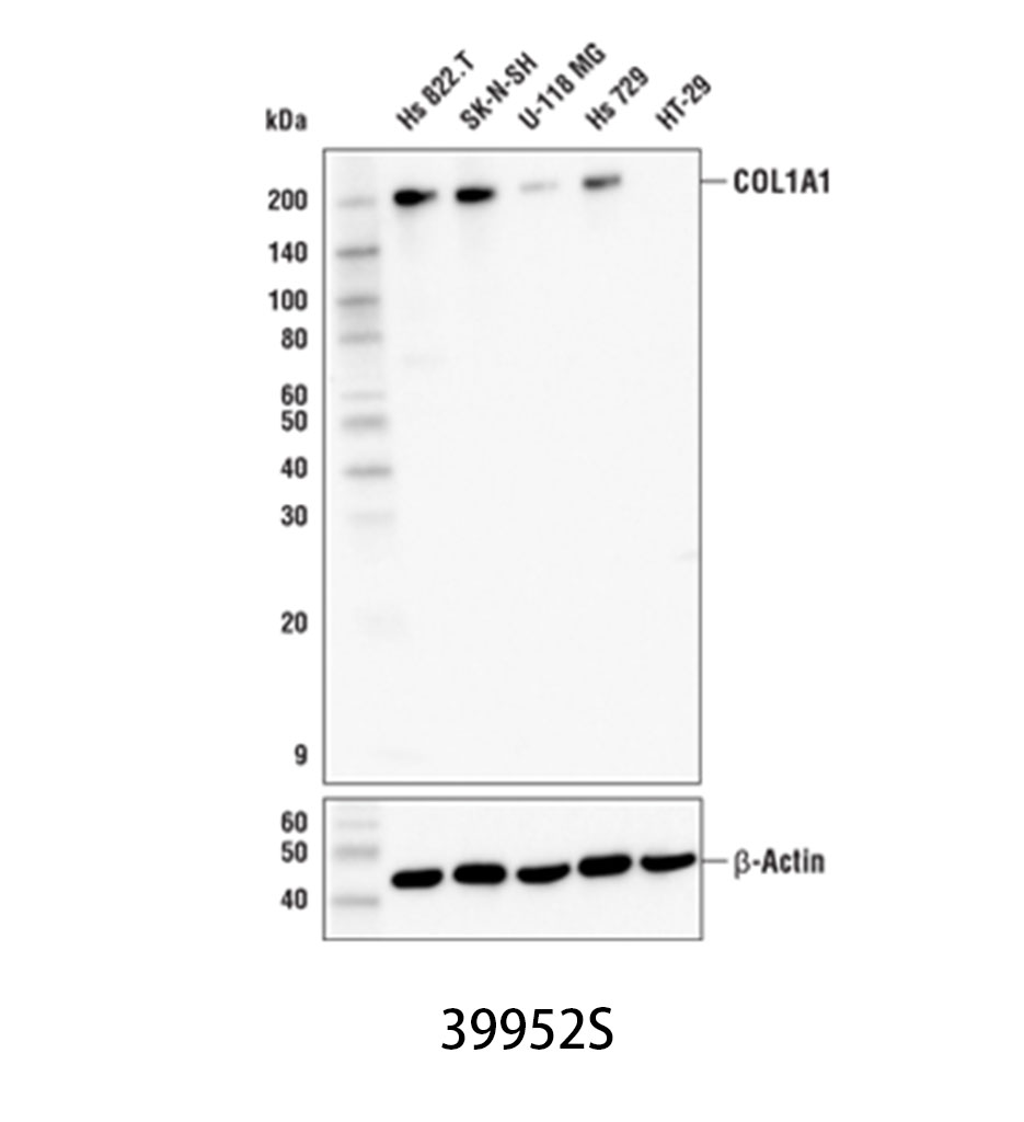 COL1A1 (E6A8E) Rabbit mAb