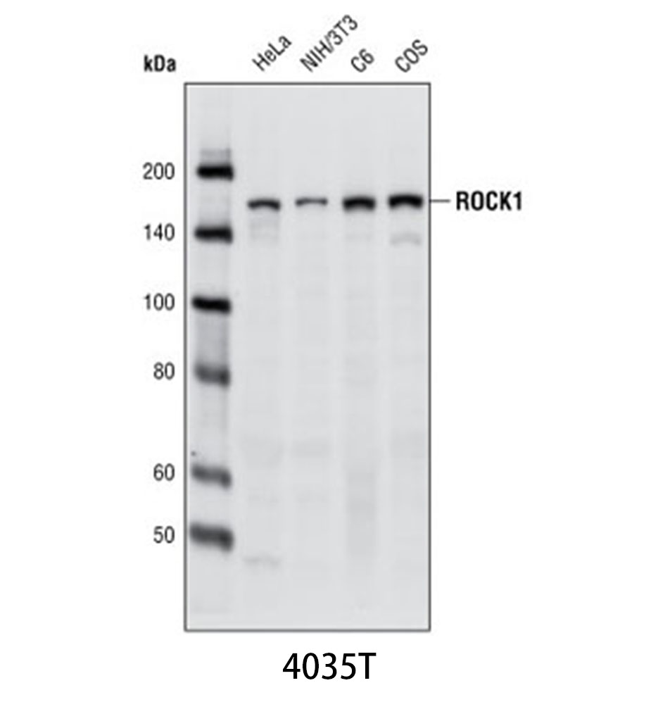 ROCK1 (C8F7) Rabbit mAb