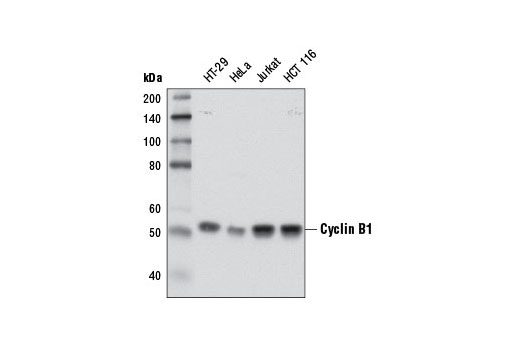 Cell Cycle Regulation Antibody Sampler Kit II