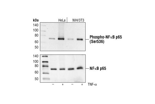 Phospho-NF-κB p65 (Ser536) (93H1) Rabbit mAb