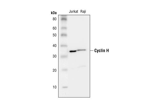 Cyclin Antibody Sampler Kit