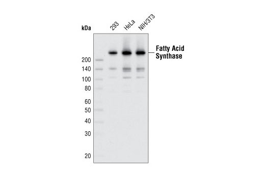 Fatty Acid Synthase (C20G5) Rabbit mAb