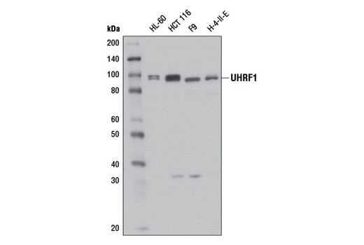 UHRF1 (D6G8E) Rabbit mAb
