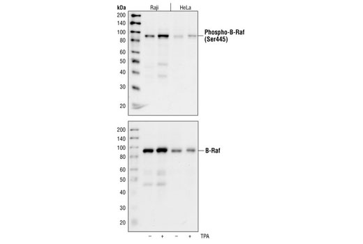 Phospho-B-Raf (Ser445) Antibody