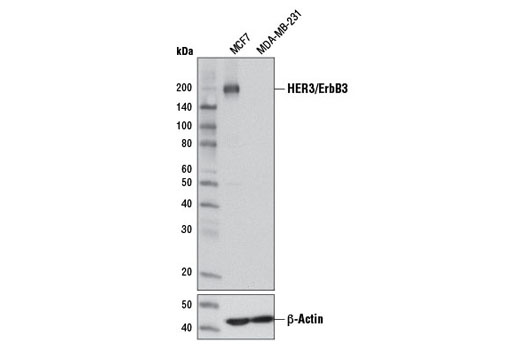 HER3/ErbB3 (D22C5) XP Rabbit mAb
