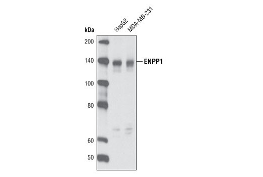ENPP1 Antibody (Human Specific)