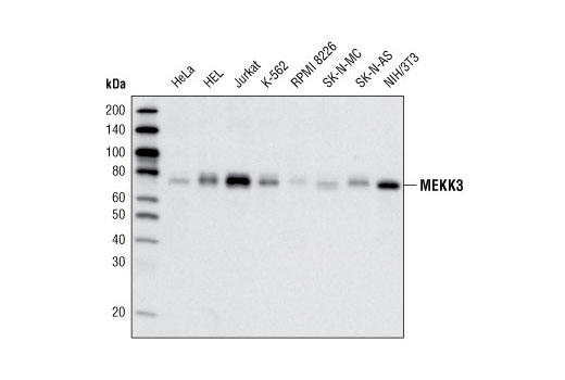 MEKK3 (D36G5) Rabbit mAb