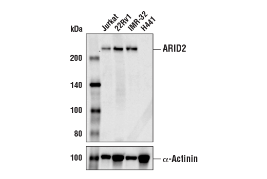ARID2 (D8D8U) Rabbit mAb