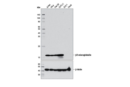 β2-microglobulin (D8P1H) Rabbit mAb