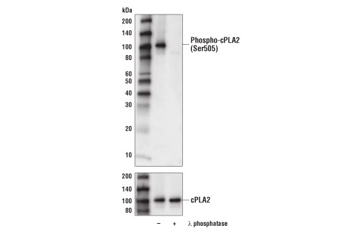 Phospho-cPLA2 (Ser505) (D4I2A) Rabbit mAb