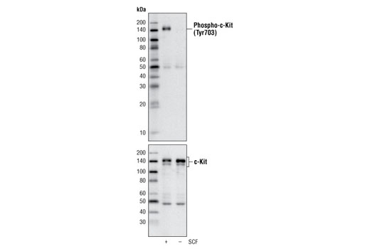 Phospho-c-Kit (Tyr703) (D12E12) Rabbit mAb