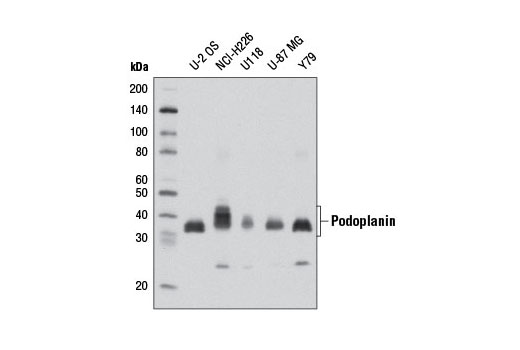 Podoplanin (D9D7) Rabbit mAb