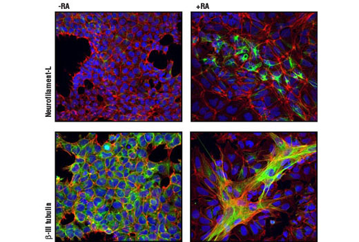 StemLight Pluripotency Antibody Kit