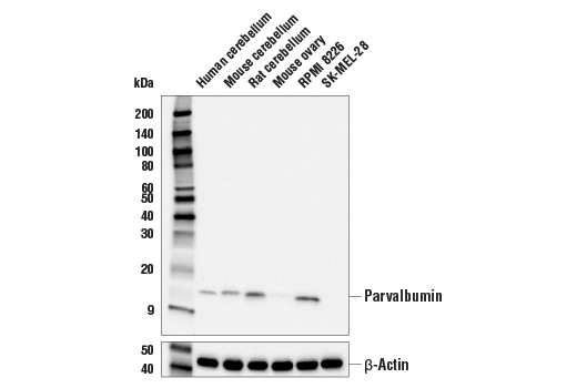Parvalbumin (E8N2U) Rabbit Monoclonal Antibody