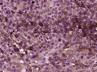 成纤维细胞激活蛋白a抗体