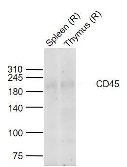 白细胞共同抗原抗体