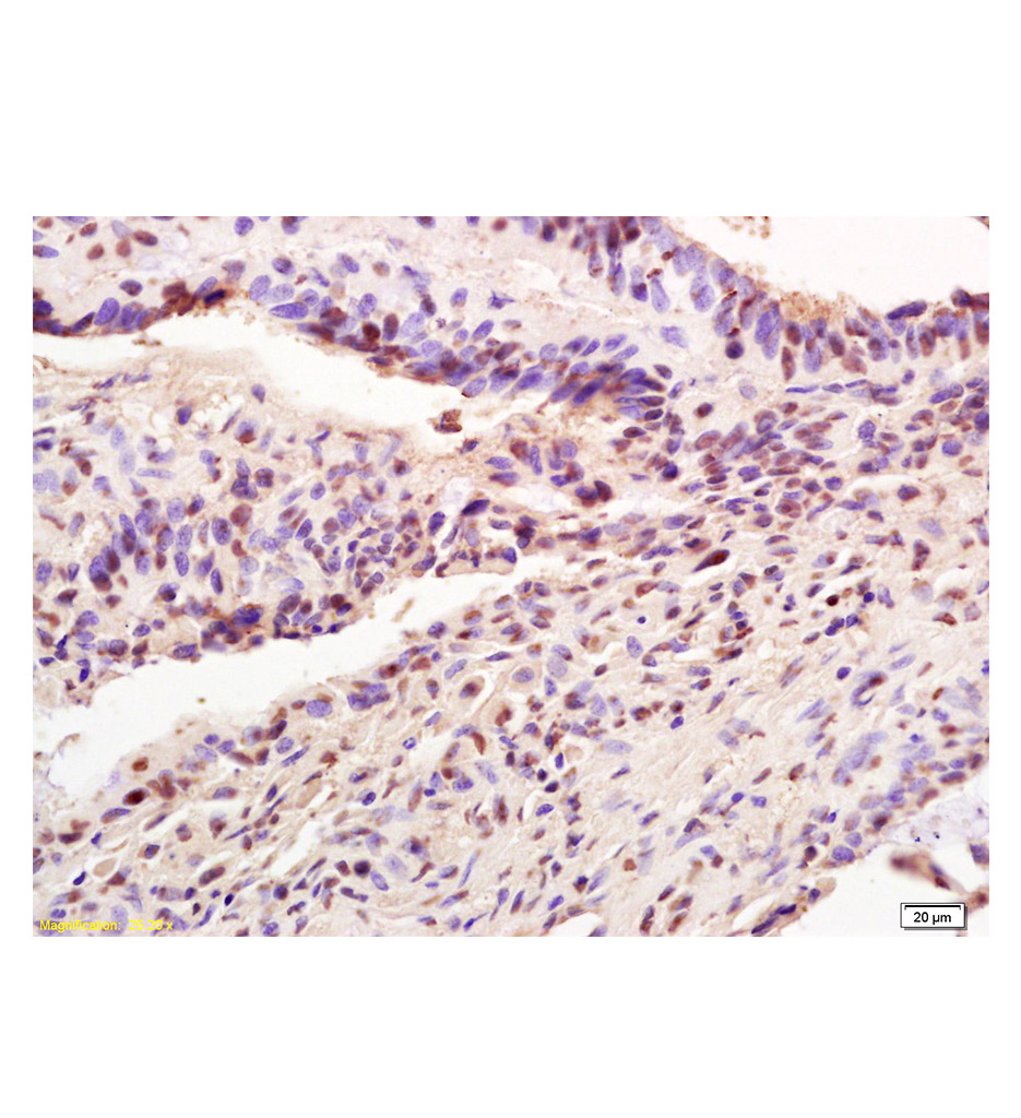 干扰素诱导蛋白AIM2抗体