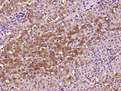 血清淀粉样蛋白A抗体