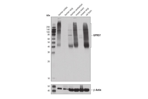 GPR37 (D4C8H) Rabbit mAb