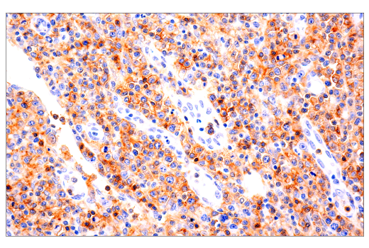 CD4 (EP204) Rabbit mAb