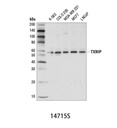 TXNIP (D5F3E) Rabbit mAb