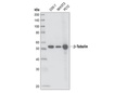 β-Tubulin (9F3) Rabbit mAb