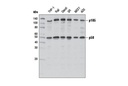 NF-κB Family Member Antibody Sampler Kit