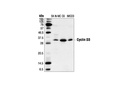 Cyclin D3 (DCS22) Mouse mAb