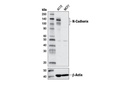 Cadherin-Catenin Antibody Sampler Kit