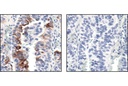 Phospho-mTOR (Ser2448) (49F9) Rabbit mAb (IHC Specific)