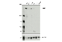 Fanconi Anemia Antibody Sampler Kit