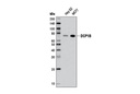 DCP1B (D2P9W) Rabbit mAb