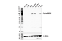 Pyrin/MEFV (E2E8U) Rabbit Monoclonal Antibody