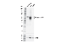 Glutaminase-1/GLS1 (E9H6H) XP Rabbit mAb